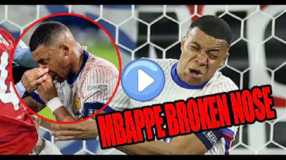 Video thumb: Mbappe Suffers Broken Nose Injury in France vs Austria Match; Controversial Yellow Card Issued