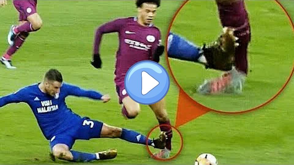 Video thumb: Leroy Sane's Left Foot Injured for Over a Month