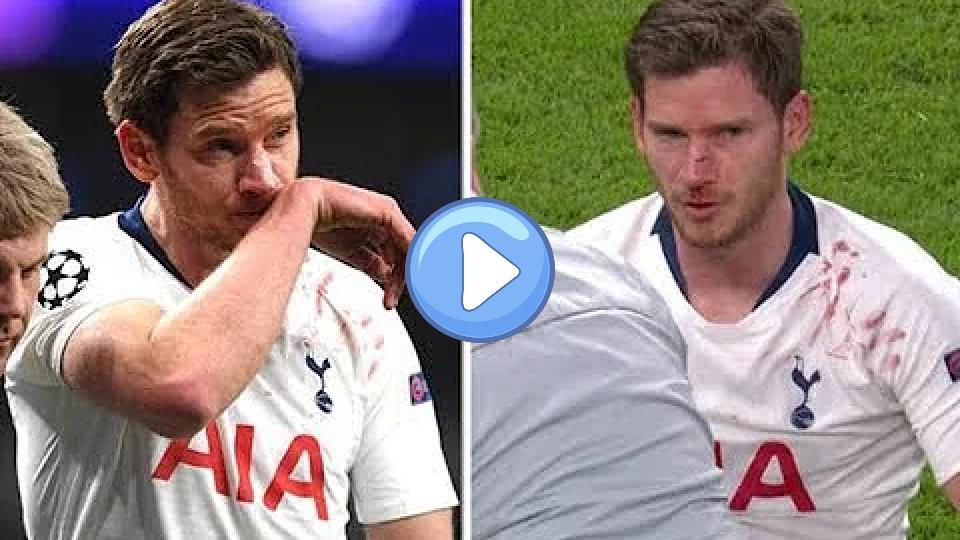 Video thumb: Vertonghen Injured as Tottenham Loses 0-1 to Ajax