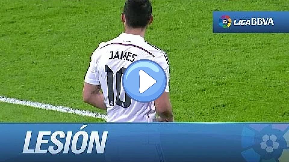 Video thumb: James Rodríguez's injury