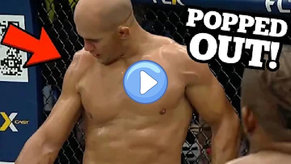 Video thumb: Junior Dos Santos Dislocates Shoulder While Throwing a Punch - Doctor Explains