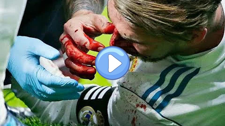 Video thumb: Ramos injury: Nasty blow by Lucas Hernandez, blood! Atletico Madrid vs. Real Madrid || 11-19-2017