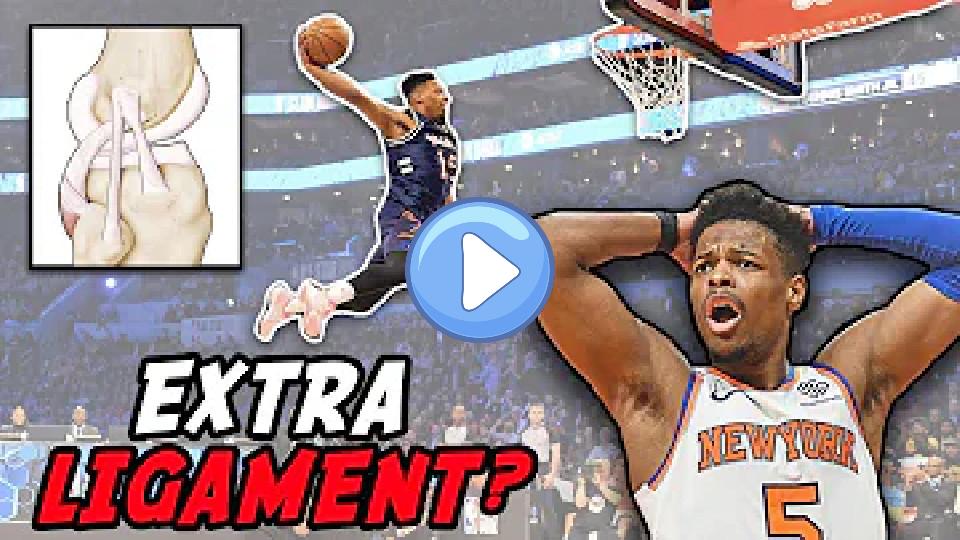 Play video: The Truth About the NBA Legend of Dennis Smith Jr's Extra Knee Ligament Video thumb: The Truth About the NBA Legend of Dennis Smith Jr's Extra Knee Ligament