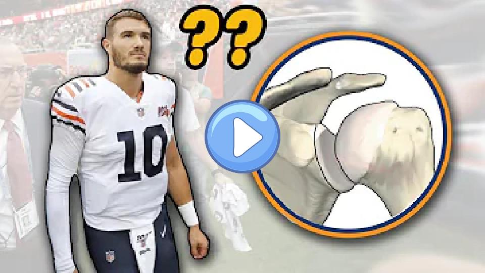 Video thumb: Doctor Reviews Mitch Trubisky's Shoulder Injury and Shoulder Dislocations
