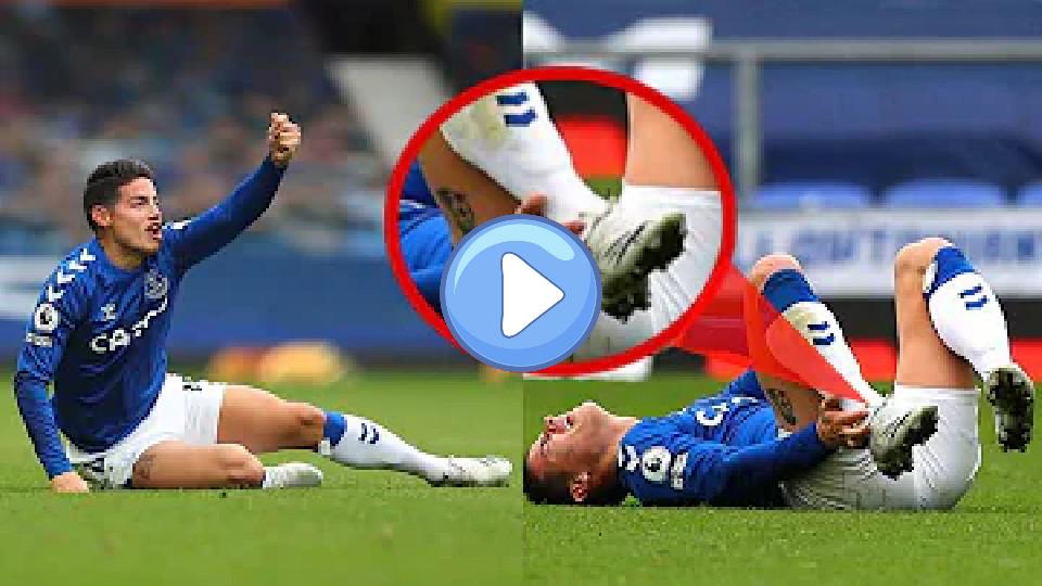 Video thumb: James Rodriguez sustains injury