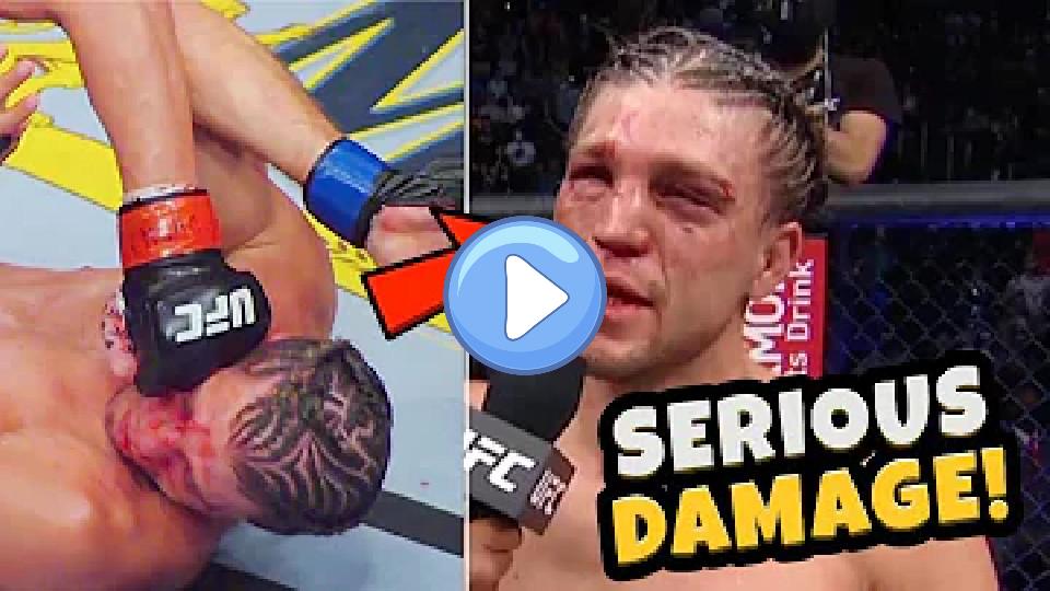 Video thumb: Brian Ortega Takes Serious Damage - Doctor Explains Injury Concerns from UFC 266 Fight of the Year