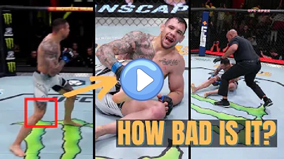 Video thumb: Expert Explains Aleksandar Rakic's Injury Possibilities & Return Timeline
