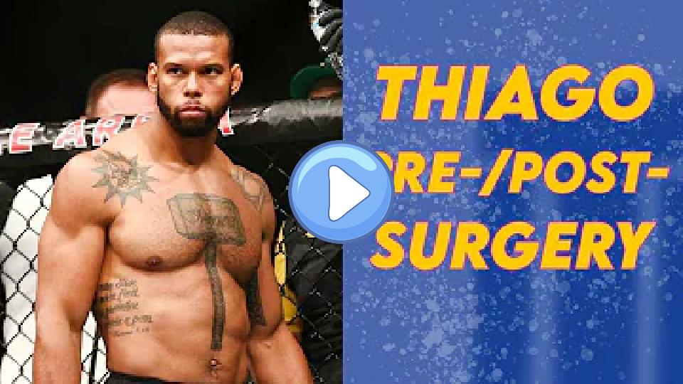 Video thumb: 3 Minutes of Thiago Santos: Pre-Knee Surgeries vs. Post-Knee Surgeries