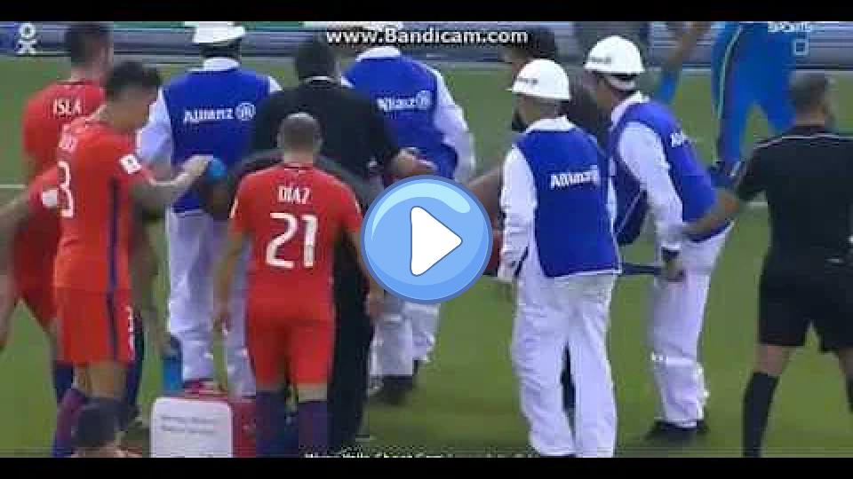 Video thumb: Horrific Injury: Arturo Vidal vs. Colombia - World Cup Qualification