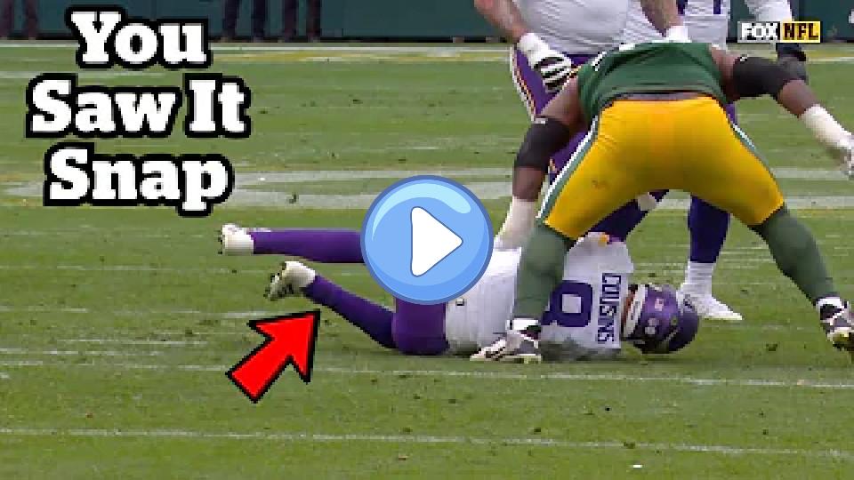 Video thumb: Kirk Cousins Ruptures His Achilles: Doctor Explains