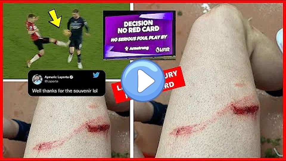 Video thumb: Aymeric Laporte Suffers Thigh Injury Against Southampton | Armstrong's Studs-Up Tackle on Laporte 😡