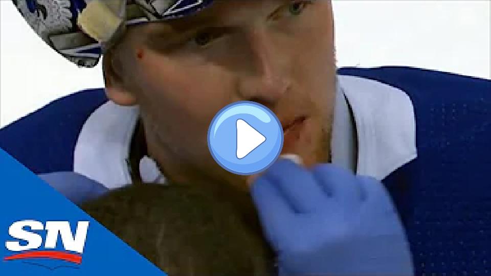 Video thumb: Andrei Vasilevskiy Left Bloodied After Taking Knee To The Head on Diving Save