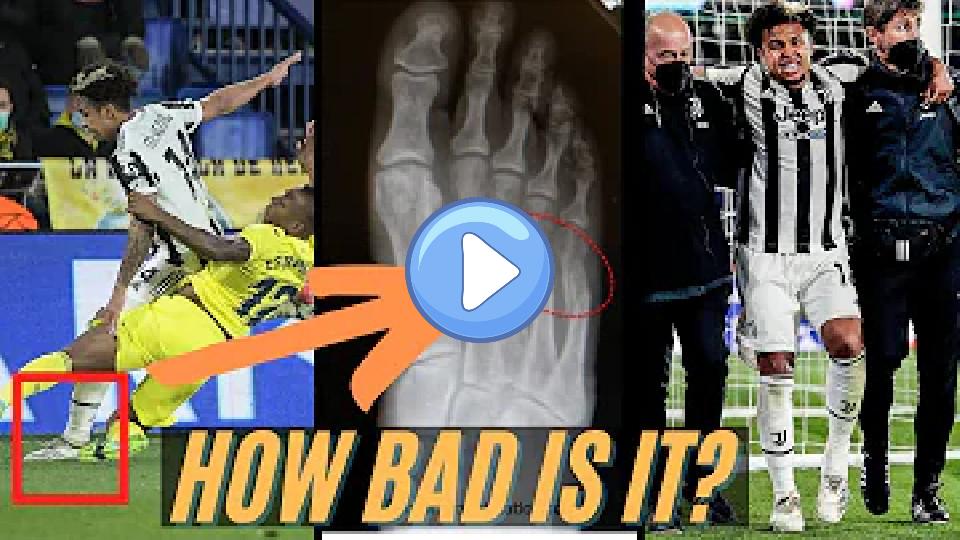 Video thumb: Expert Explains Weston McKennie's Injury (Left Foot) and Timeline Scenarios