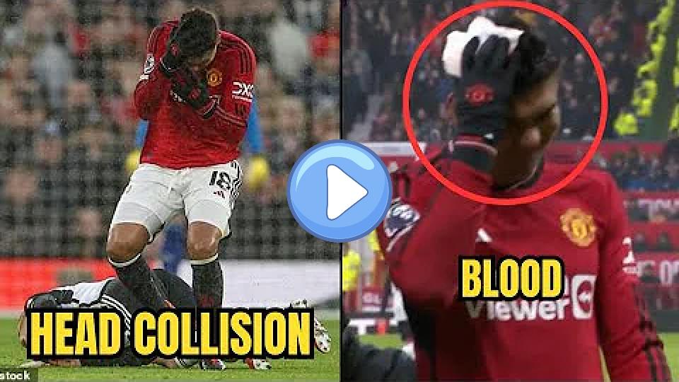 Video thumb: Casemiro Left Bloodied after Horrible Head Collision 😳😳 | Man United vs Fulham 1-2 | Shirt Swap