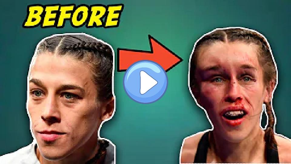 Video thumb: Massive Hematoma! Doctor Explains Joanna Jedrzejczyk's Forehead Injury at UFC 248