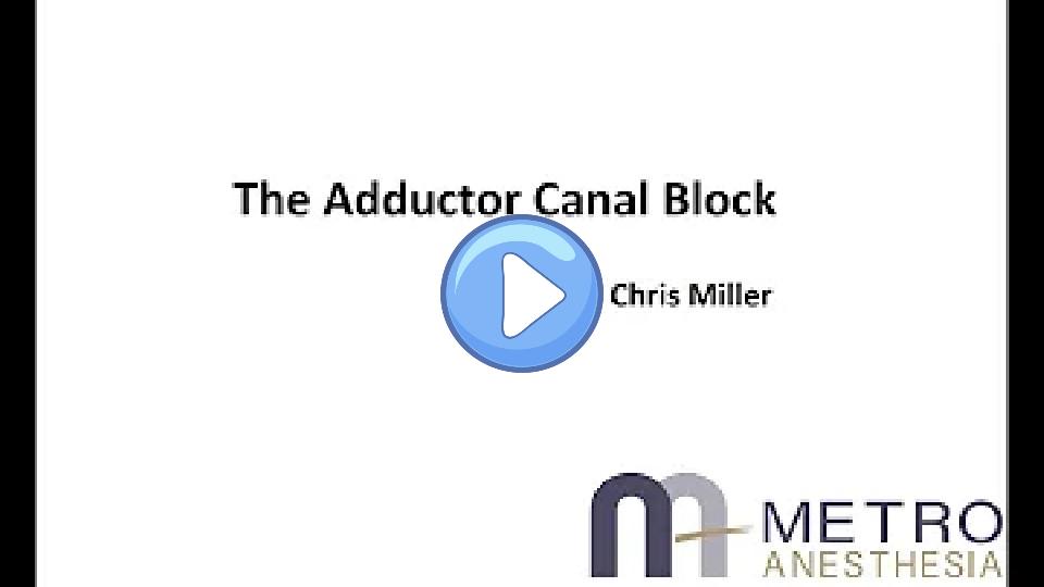 Play video: Adductor Canal Block: Knee vs. Ankle by Dr. Chris Miller Video thumb: Adductor Canal Block: Knee vs. Ankle by Dr. Chris Miller
