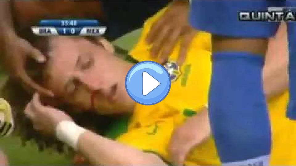 Video thumb: David Luiz sustained a broken nose during the Brazil vs Mexico match in the Confederations Cup 2013.