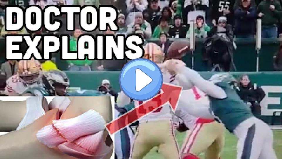 Video thumb: Brock Purdy Elbow Injury: How Severe Is It? Doctor Explains