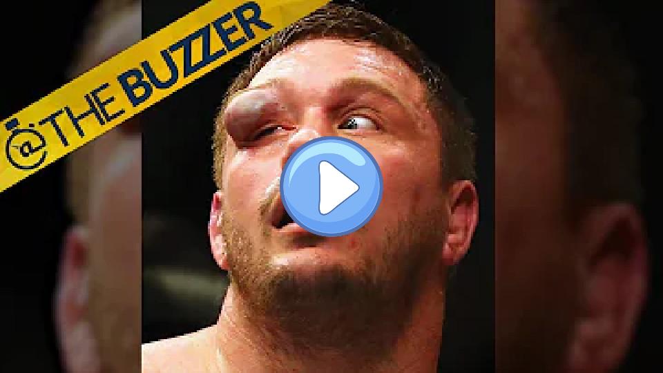 Video thumb: A UFC fighter's severe eye injury is difficult to look at.