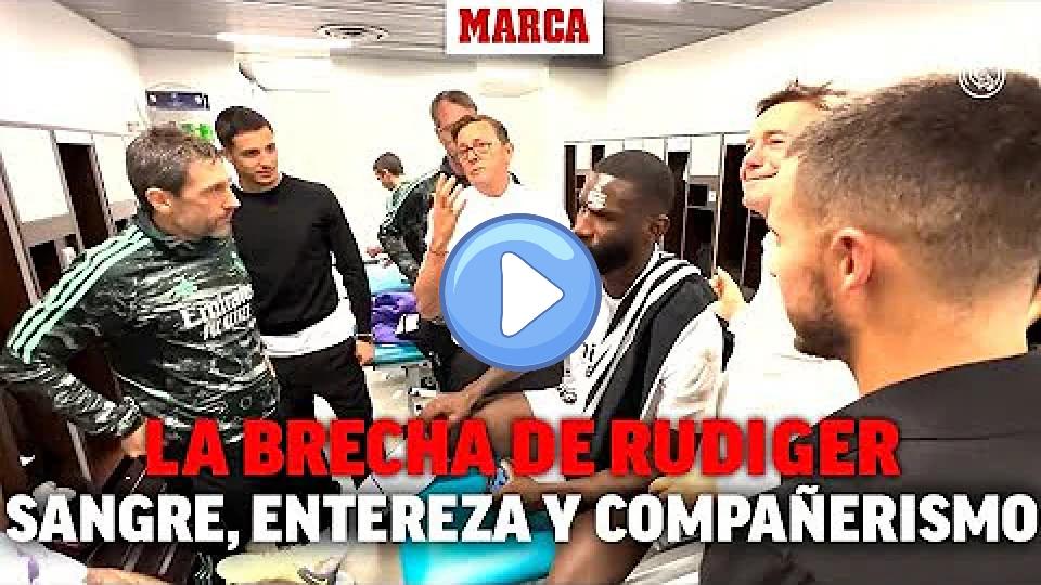 Video thumb: This is how Rudiger's injury was handled in the locker room: blood, resilience, and great camaraderie I MARCA