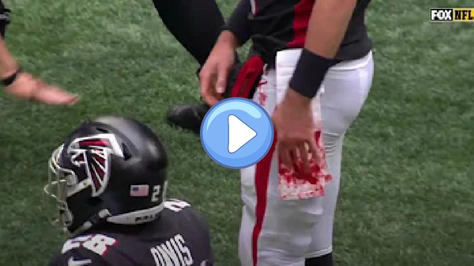 Video thumb: Matt Ryan's hand was bloody after getting cleated.