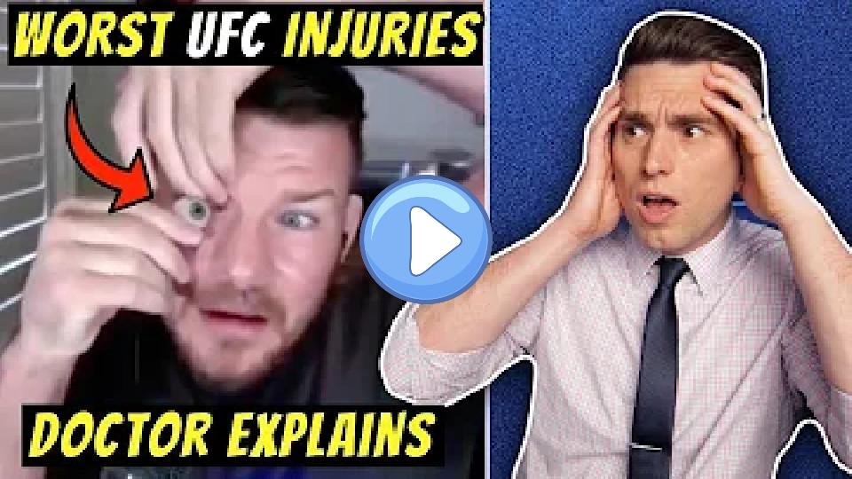 Video thumb: Worst UFC Injuries Ever! Doctor Explains Shocking Michael Bisping Eye Injury Story